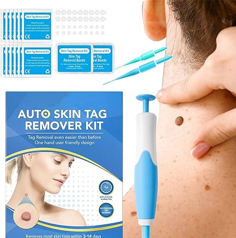 2-in-1 Skin Tag Remover Kit – Fast, Safe, and Painless Solution for Removing Skin Tags in UAE مجموعة إزالة الزوائد الجلدية 2 في 1 – حل سريع وآمن لإزالة الزوائد الجلدية في الإمارات